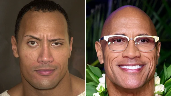 The Rock's Ageless Look: Genetics or Surgery?