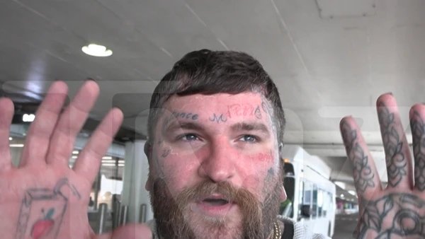 Teddy Swims Faces Brutal Sunburn After Coachella, Heads Straight to Stagecoach