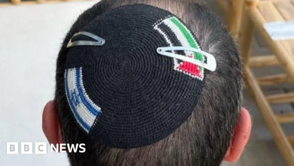 Israeli Police Under Investigation After Cutting Palestinian Flag From Jewish Head Covering