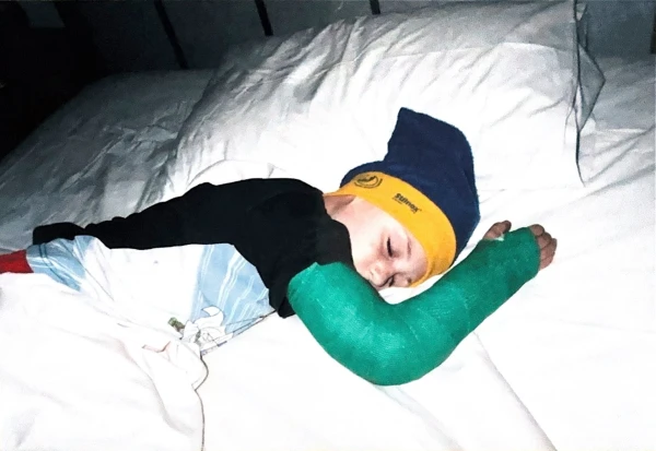 A moment that changed me: I broke my arm seven times – and finally listened to what my body was telling me