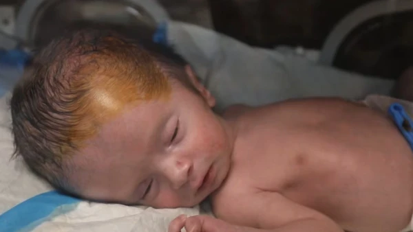 Gaza's Hidden War Toll: Stillbirths Skyrocket 140% as Birth Defects Double Amid Ongoing Conflict