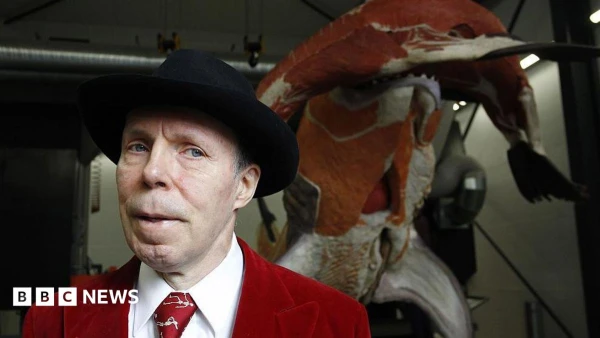 Body Worlds Creator Gunther von Hagens Leaves a Lasting Legacy