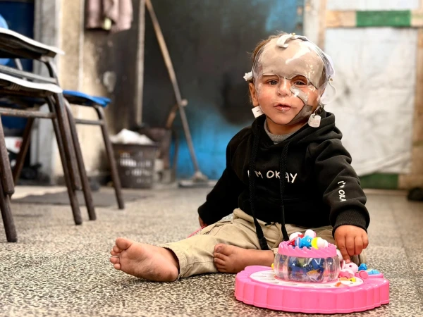 Gaza's Infant Survivors Bear Lifelong Scars from War and Collapsed Healthcare