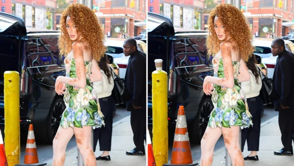 Can You Spot the Differences? Winnie Harlow Stuns NYC in Fun Photo Challenge
